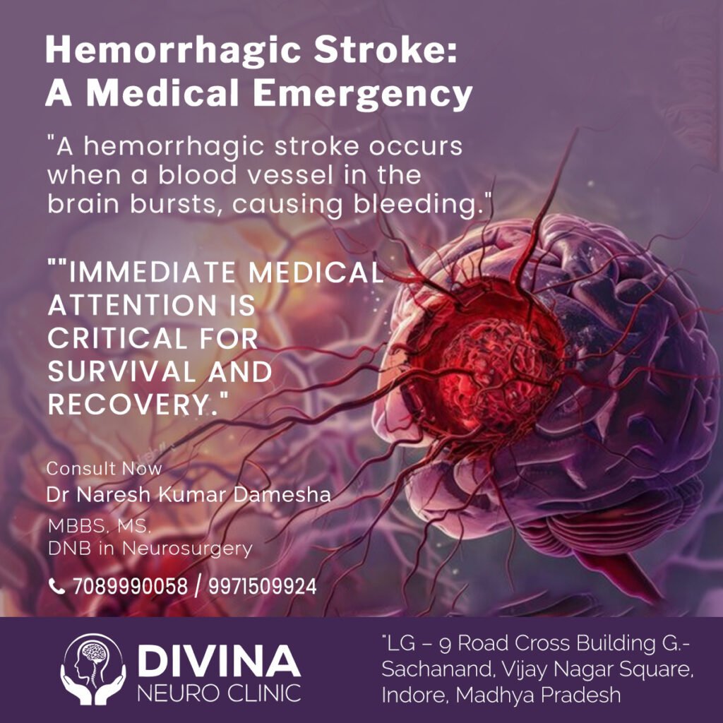 What is Hemorrhagic Stroke?, Causes, Symptoms, Treatment 